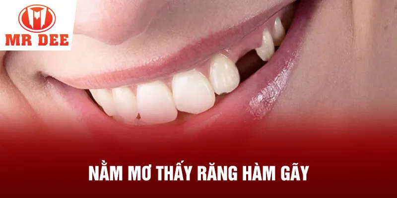 Nằm mơ thấy răng hàm gãy